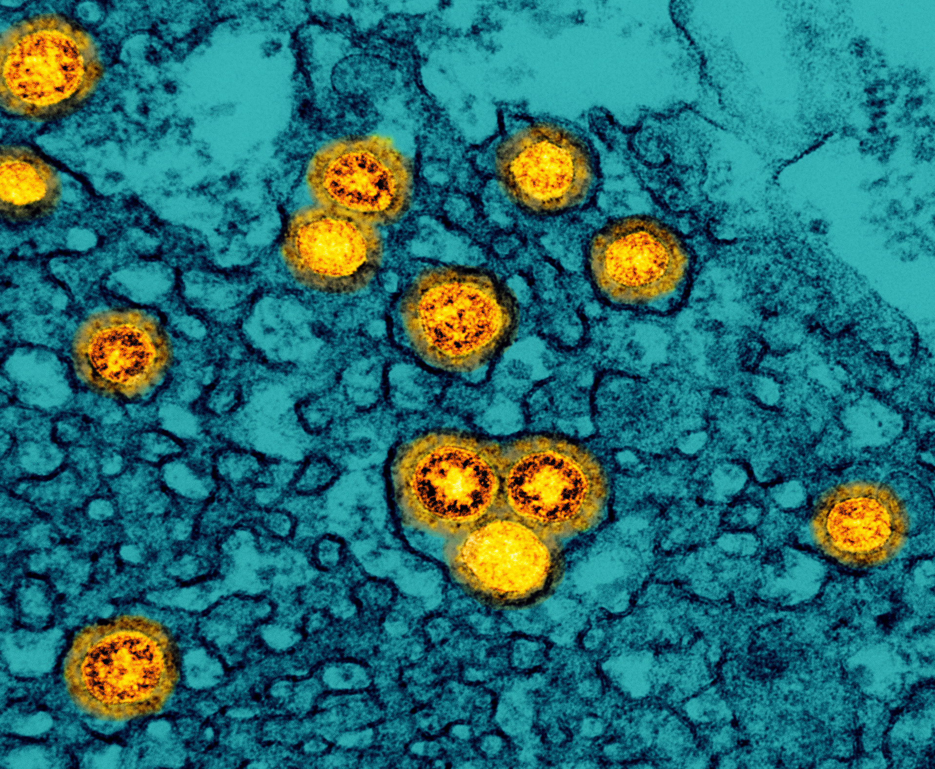 Omicron seen as milder coronavirus but scientists aren't sure