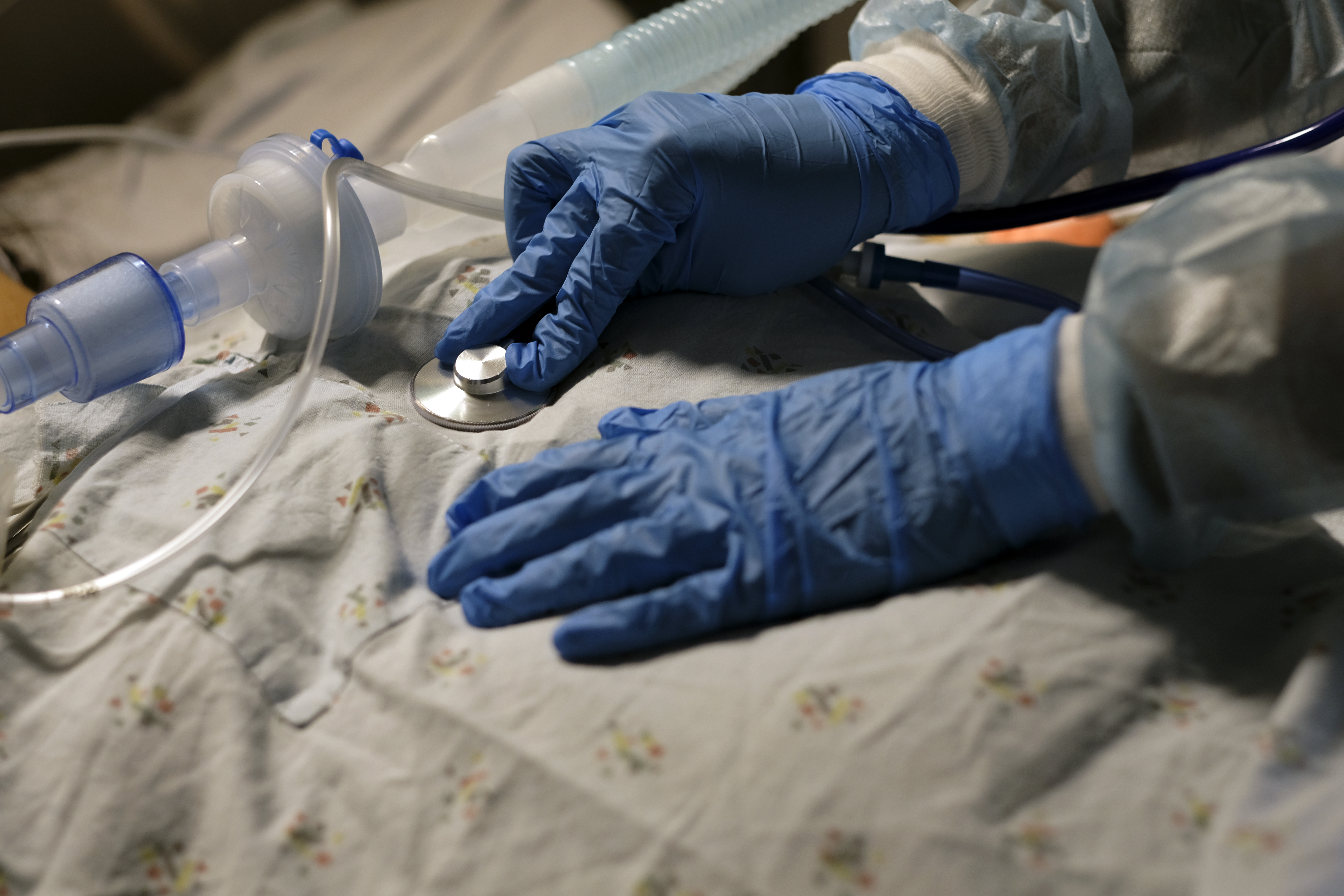 Delta doubles hospitalization risk for the unvaccinated - Vimarsana News