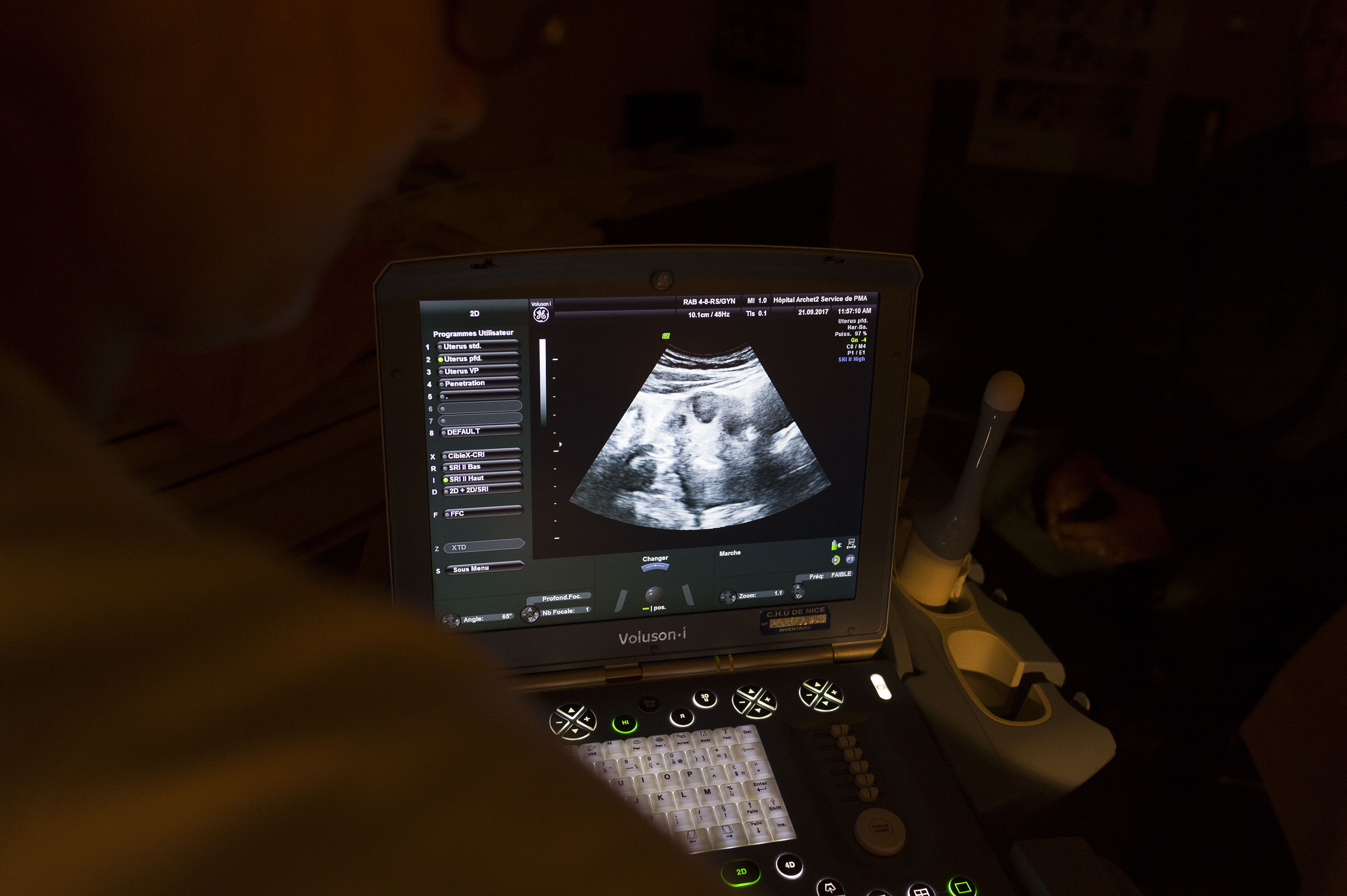 Startup Orchid claims it picks healthier embryos. Does it? - Vimarsana News