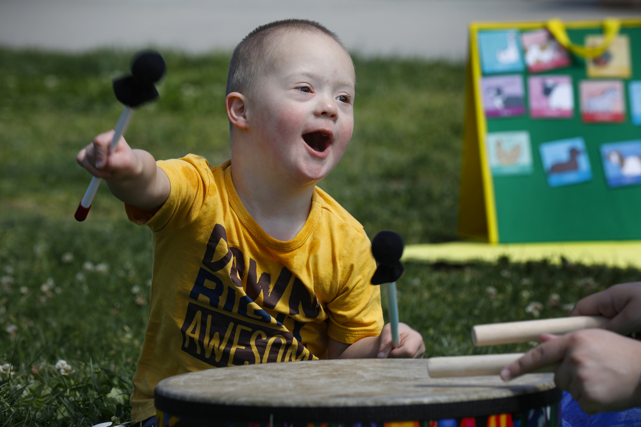 Down syndrome celebration reminds families they are not alone - Vimarsana News