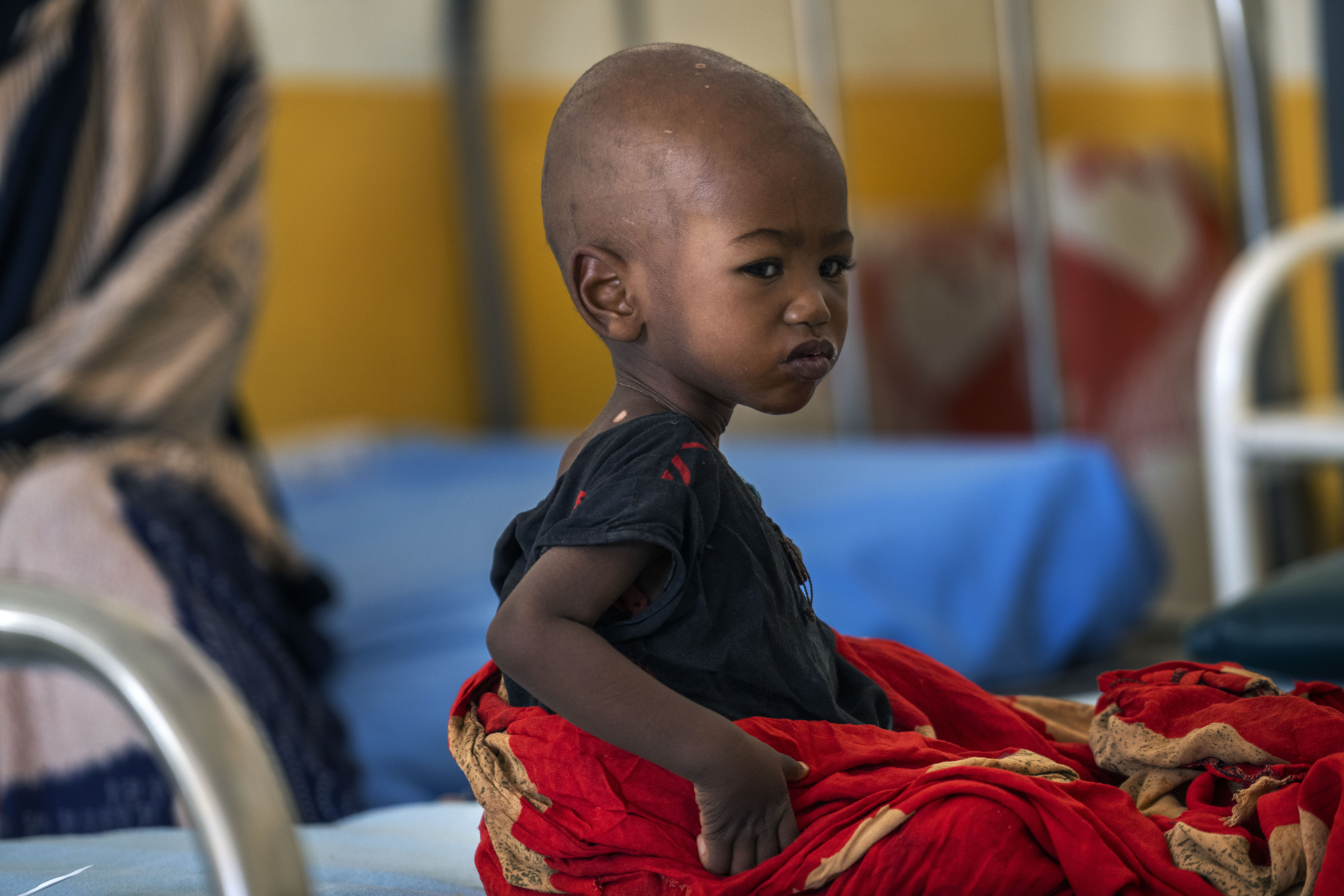 A look at famine and its toll as Somalia faces rare, dire declaration - Vimarsana News