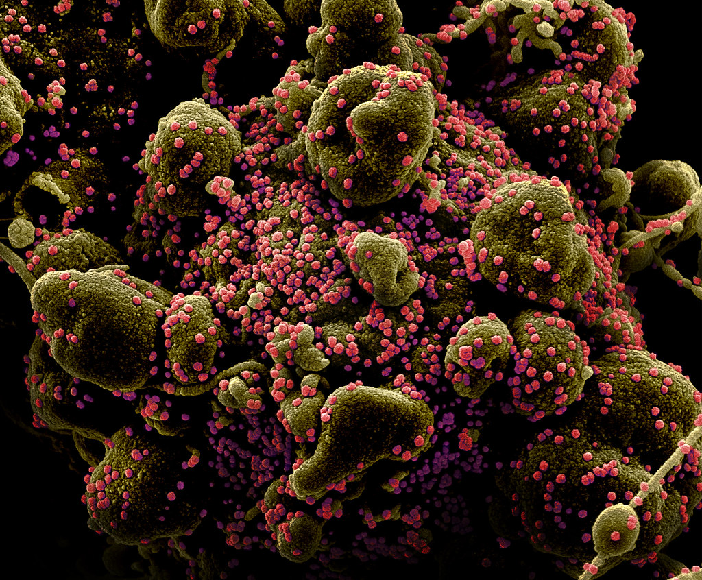 La Jolla News Nuggets: Coronavirus outbreaks and testing, food drive, Actors Fund award - Vimarsana News