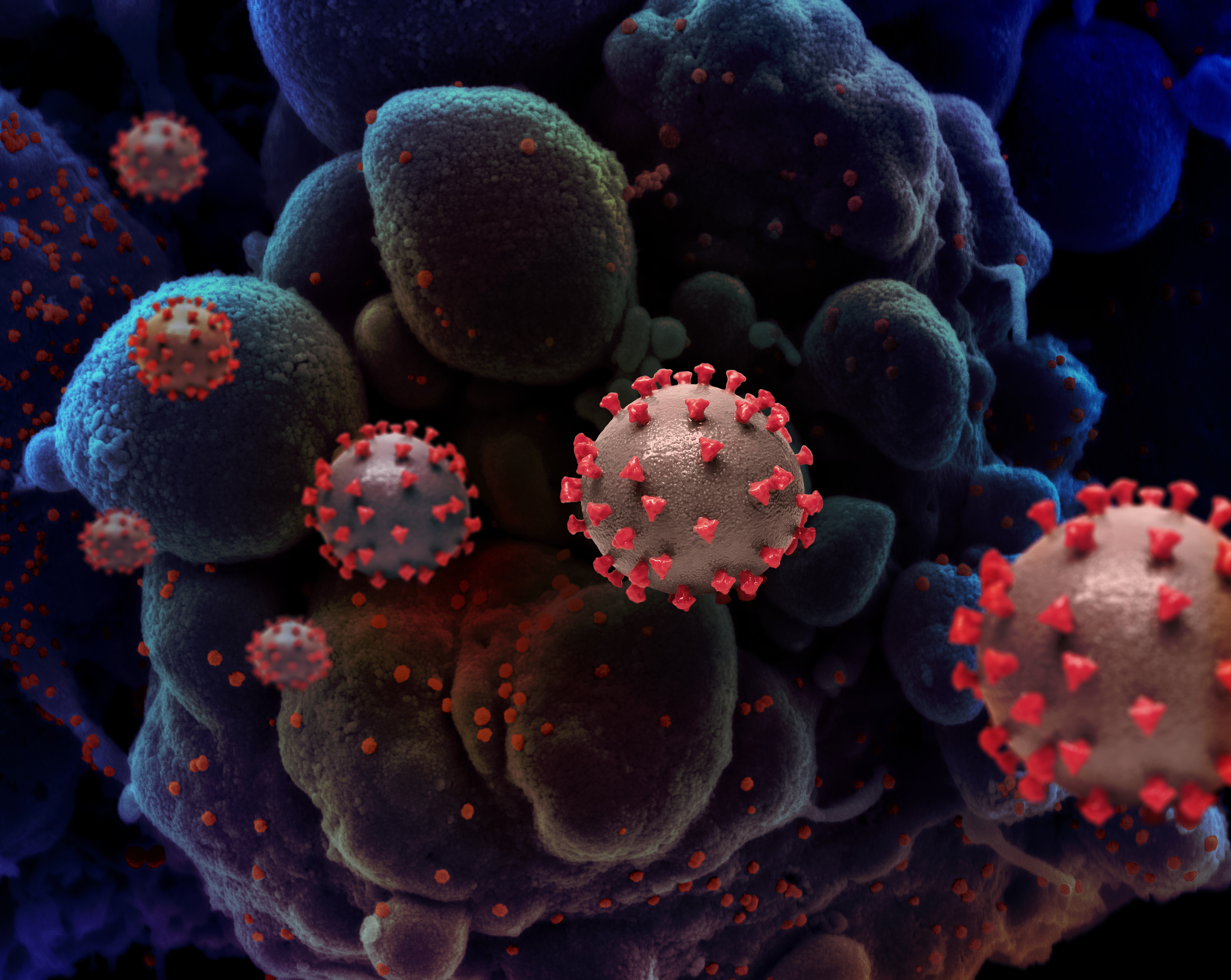 'Double mutant' coronavirus variant found in California - Vimarsana News