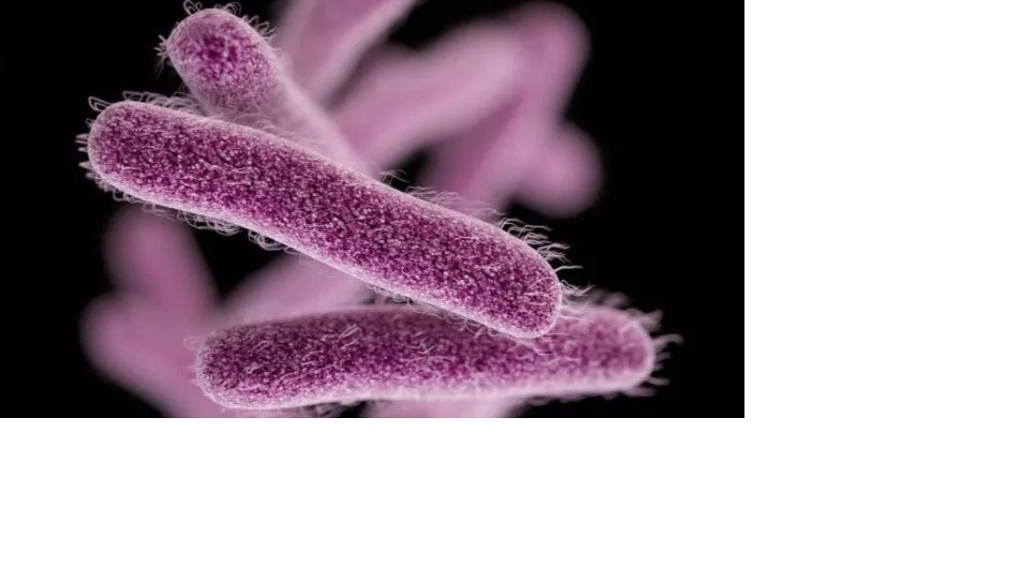 Shigella outbreak reported among San Diego homeless - Vimarsana News