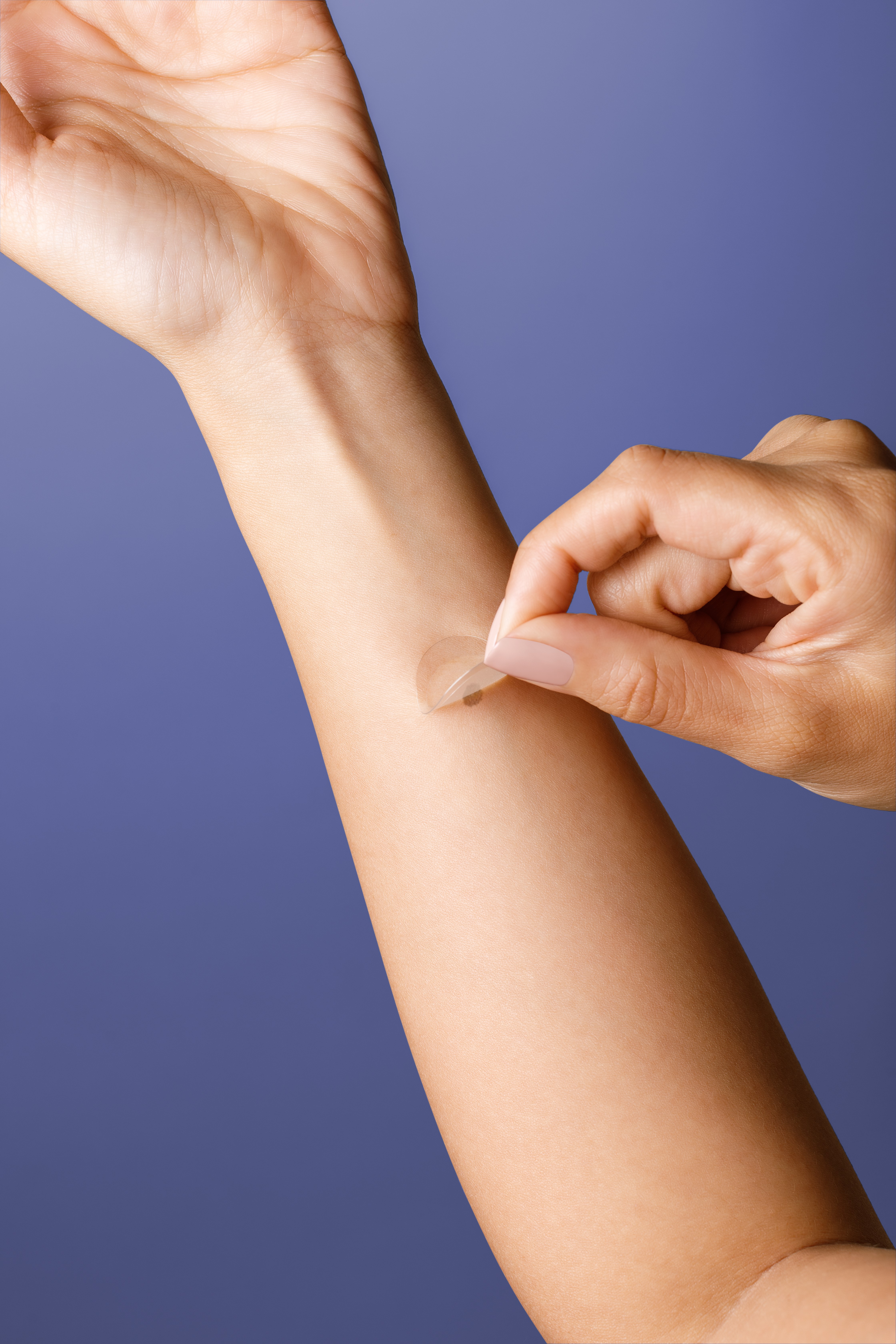 'A better way to diagnose melanoma': La Jolla's DermTech develops Smart Sticker for the skin - Vimarsana News