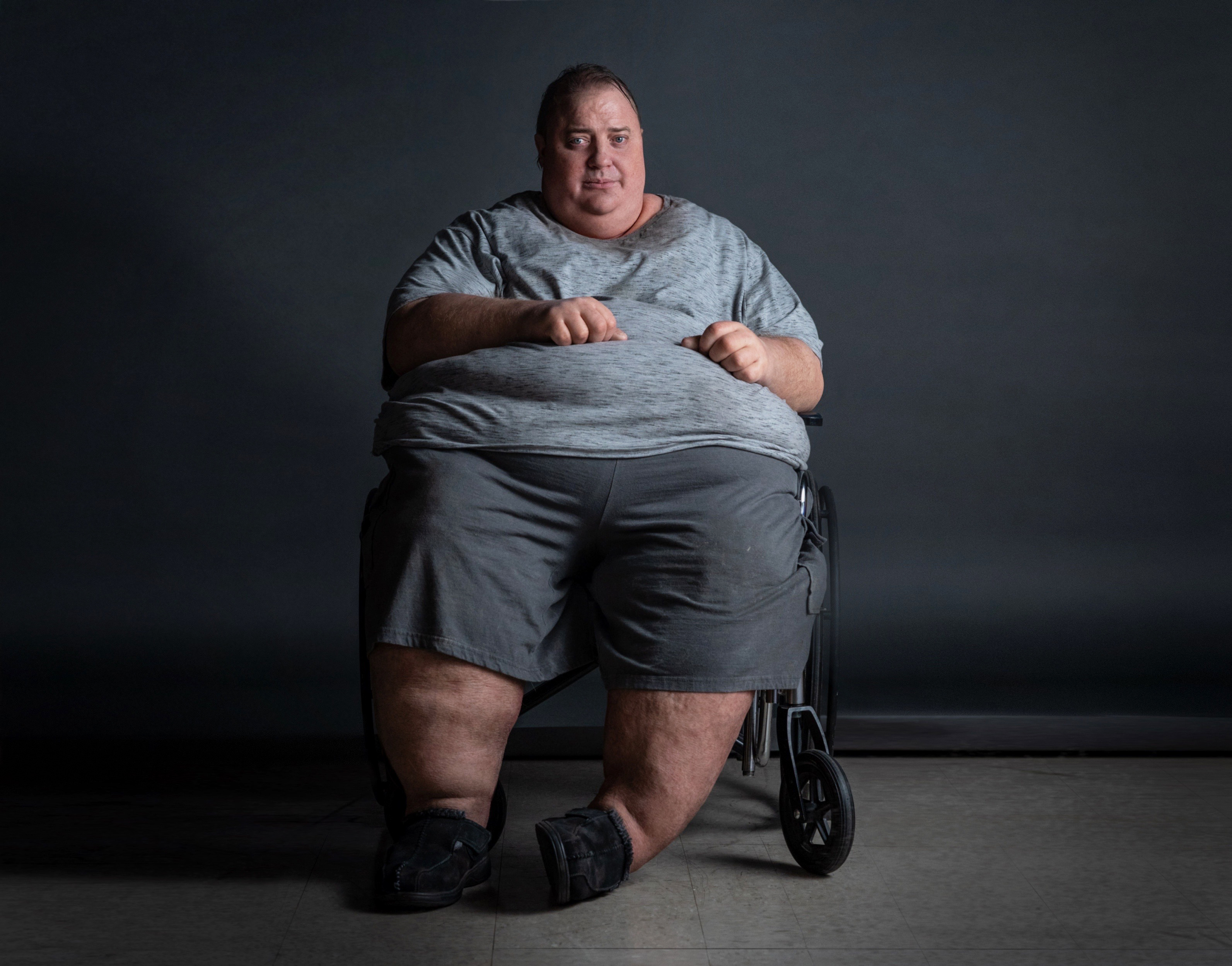 How 'The Whale' prosthetics blaze new trails with technology - Vimarsana News