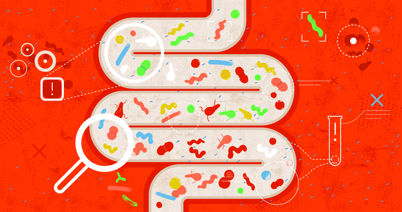 Eating fiber alters the microbiome. It may help in cancer fight, too. - Vimarsana News