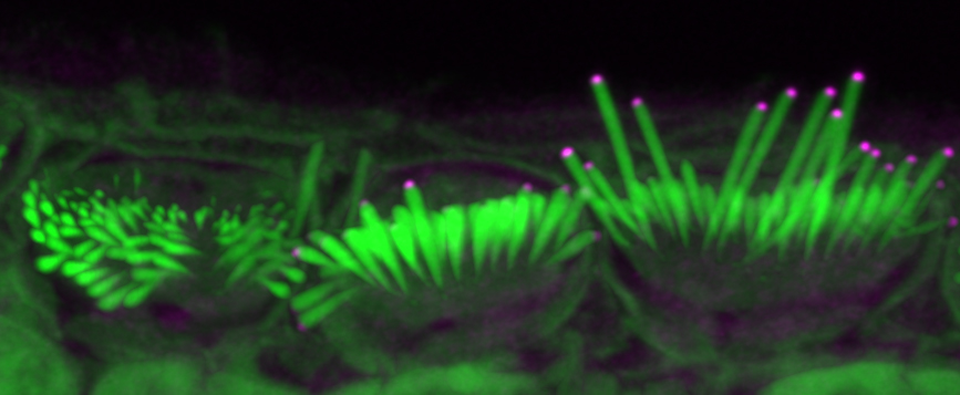 Salk discovery advances potential of gene therapy to restore hearing loss - Vimarsana News