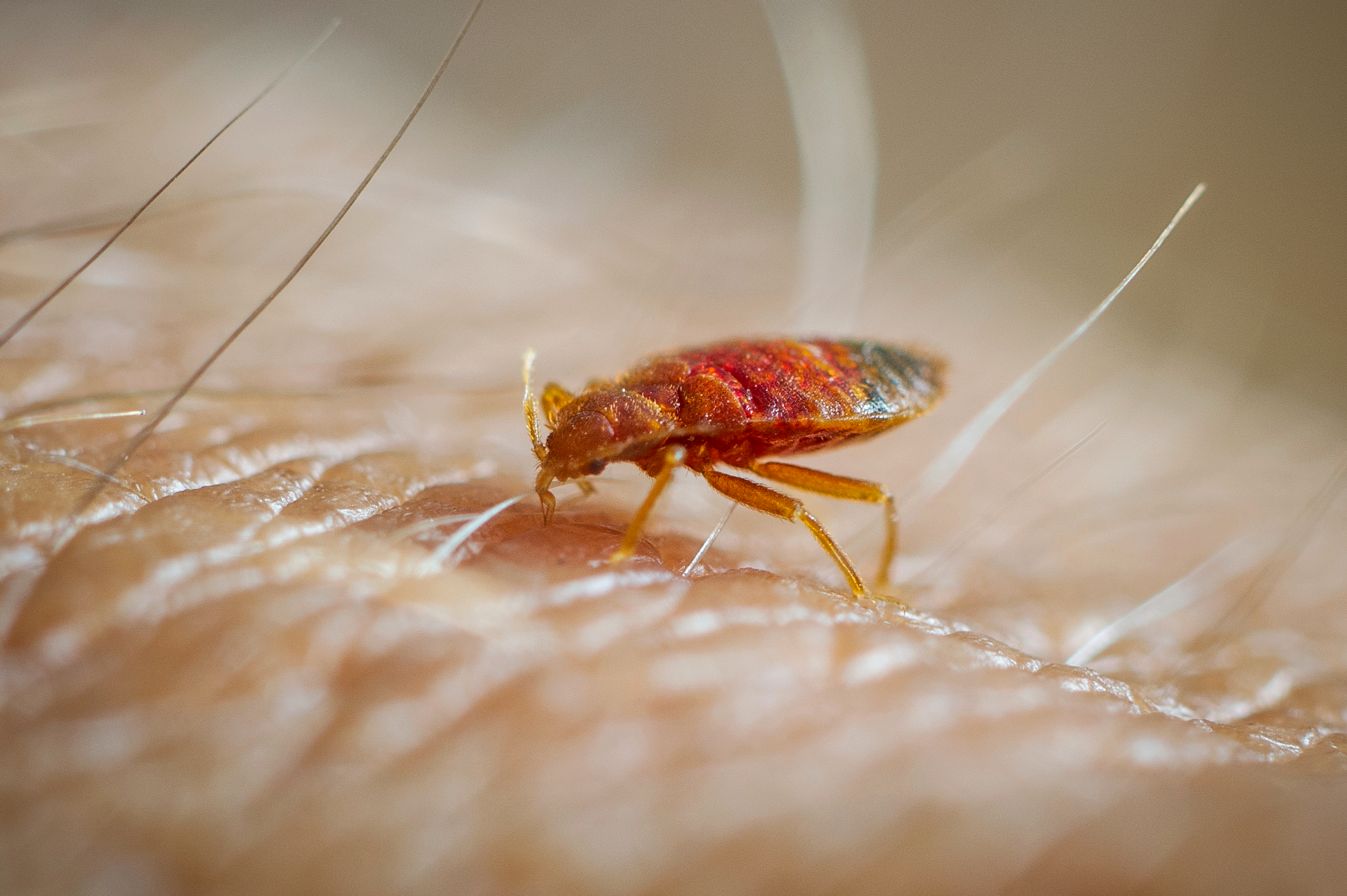 British tourist awarded $375,000 after suffering hundreds of bed bug bites at infested Hollywood Hills home - Vimarsana News