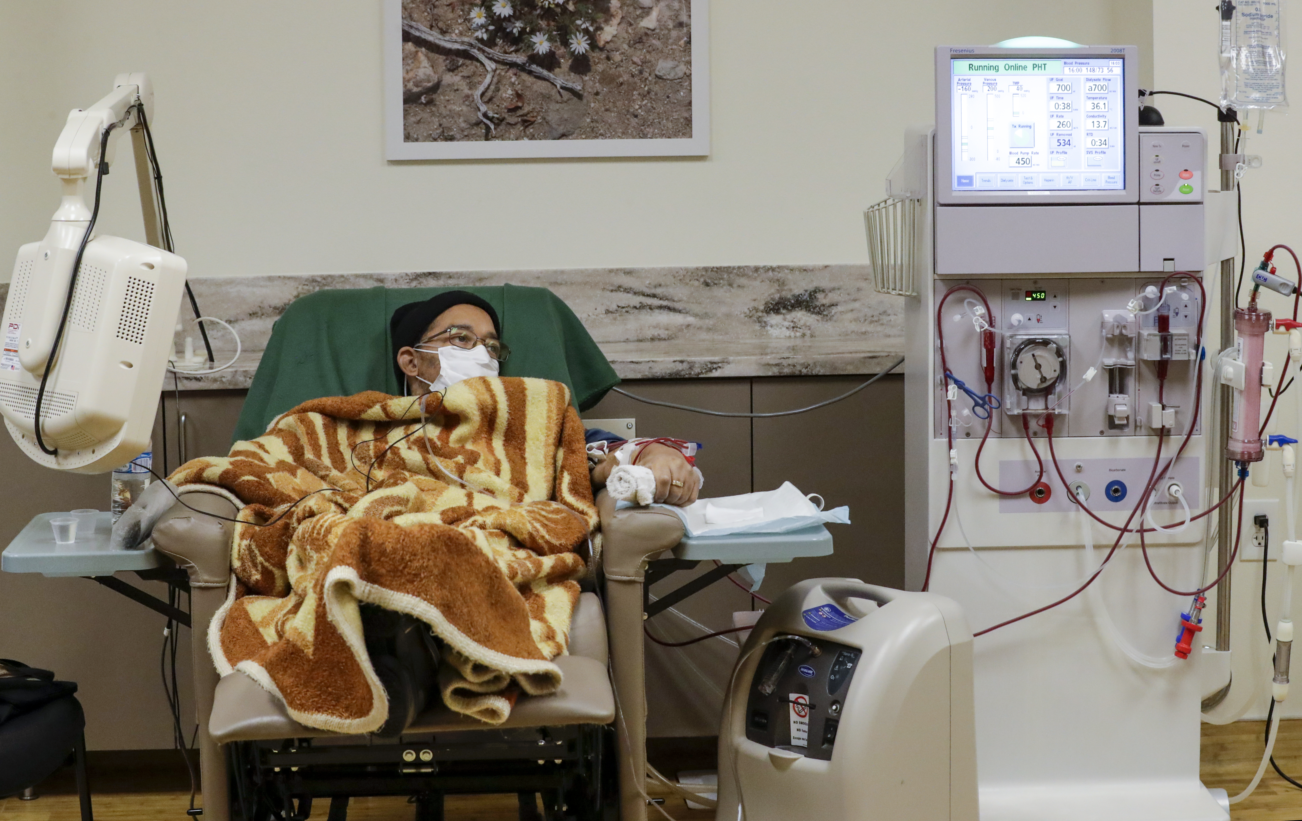 Hiltzik: Prop. 29 threatens the for-profit dialysis business - Vimarsana News
