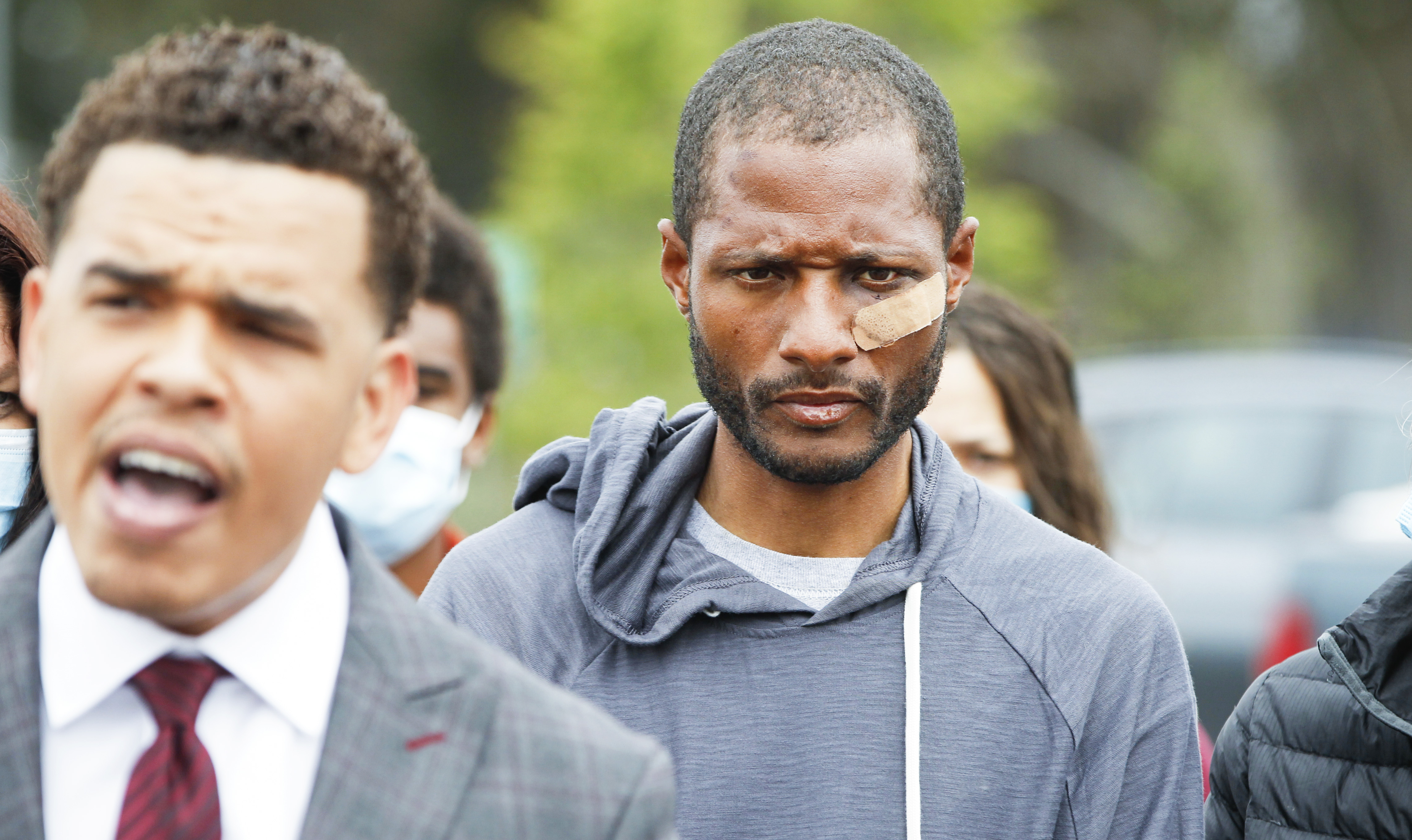 City attorney declines to charge homeless Black man beaten during La Jolla arrest - Vimarsana News