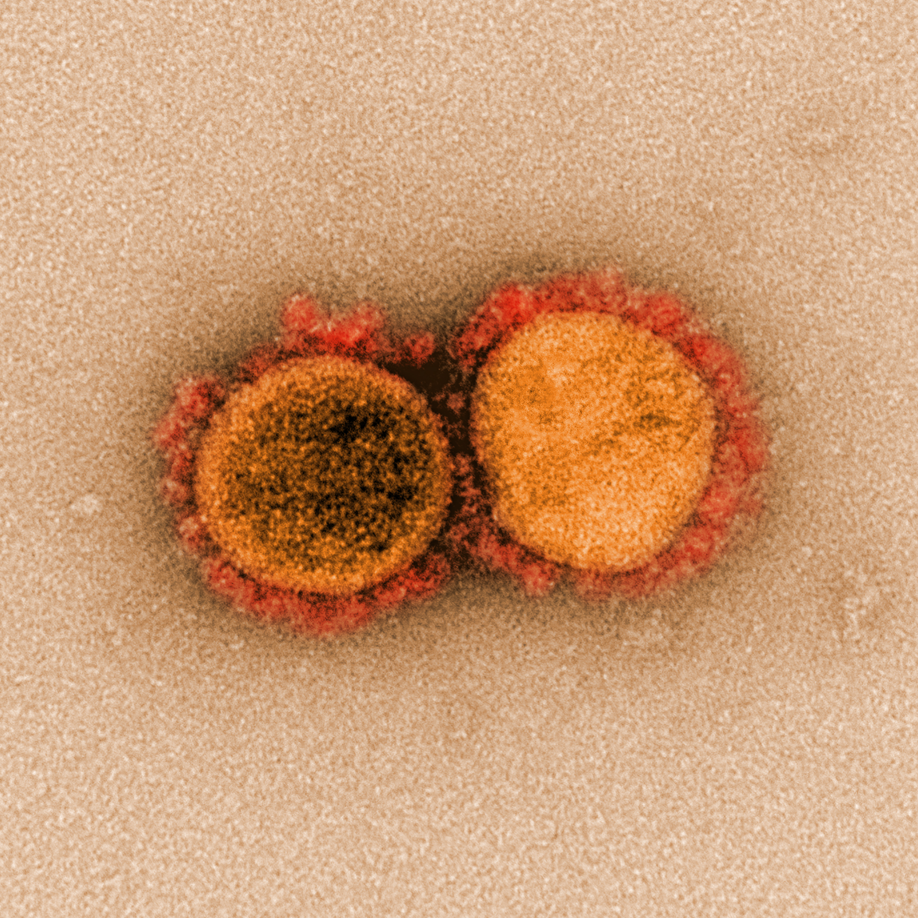 The 'nightmare scenario' for California's coronavirus strain - Vimarsana News
