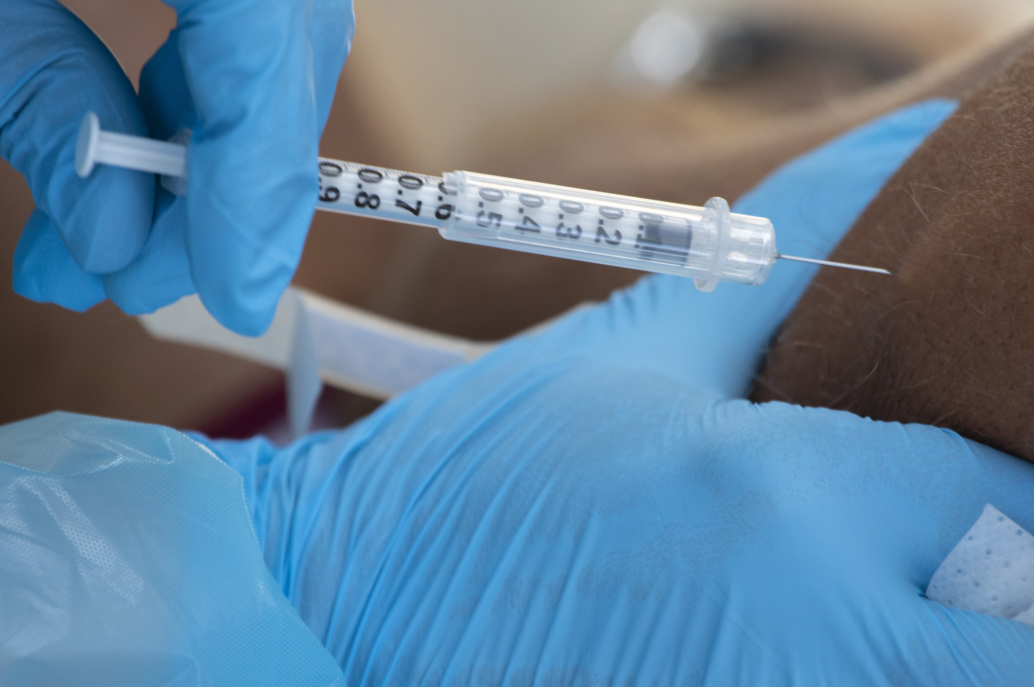 MPX vaccine eligibility and how to get one - Los Angeles Times - Vimarsana News