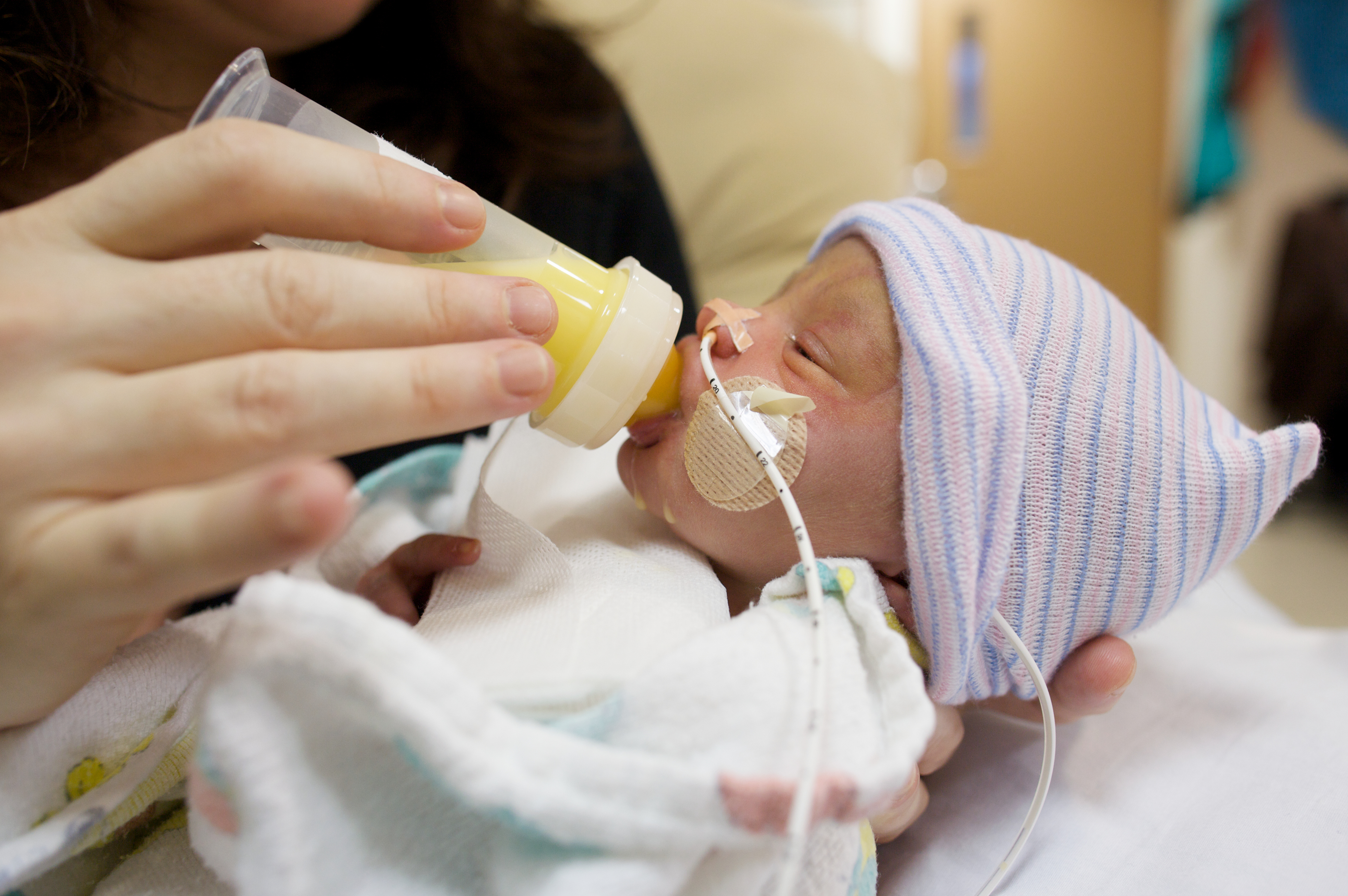 Parents of premature babies stressed, fearful amid formula shortage - The San Diego Union-Tribune - Vimarsana News