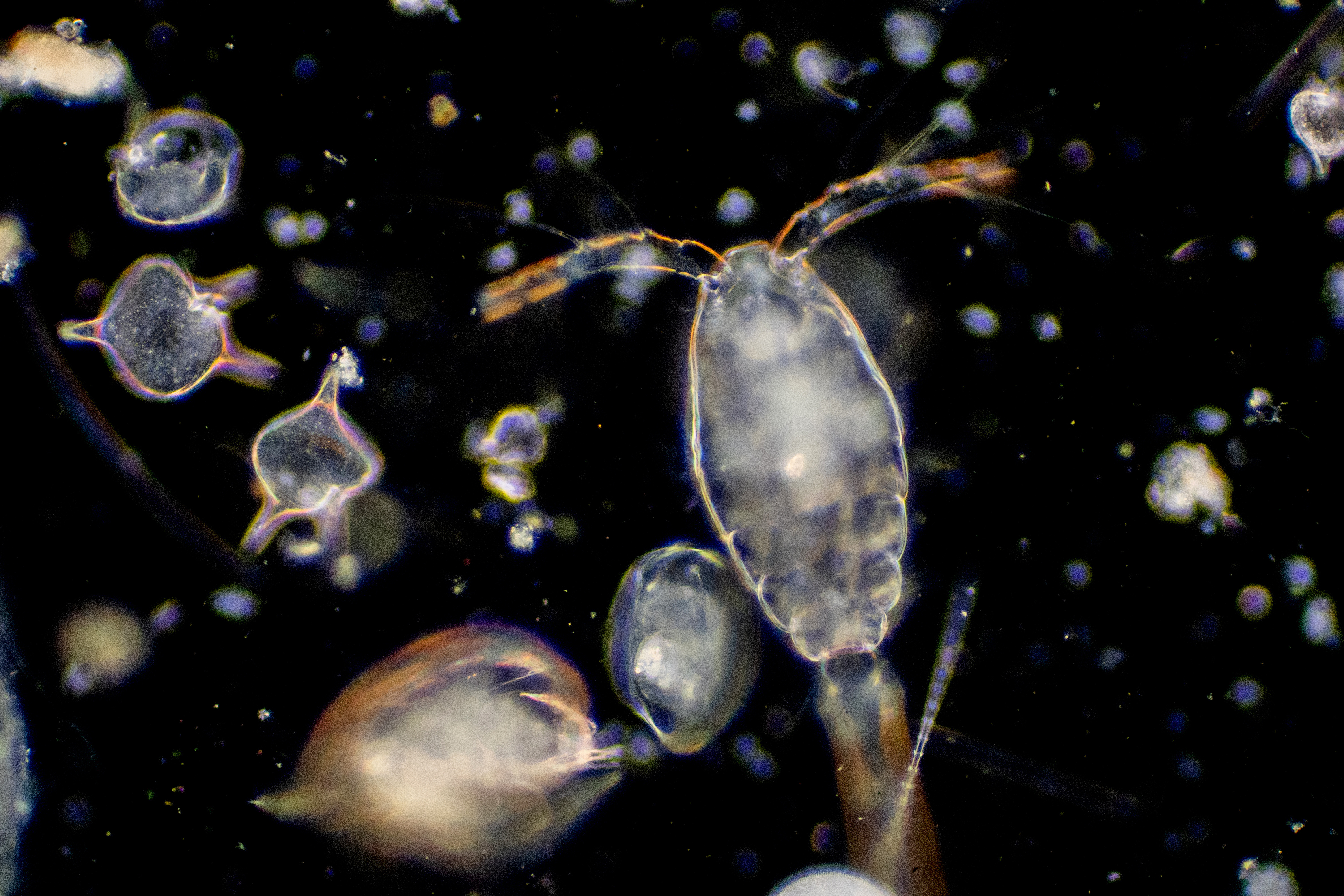 Chemicals found in plankton could be used to study chronic illnesses in humans, UCSD researchers say - Vimarsana News
