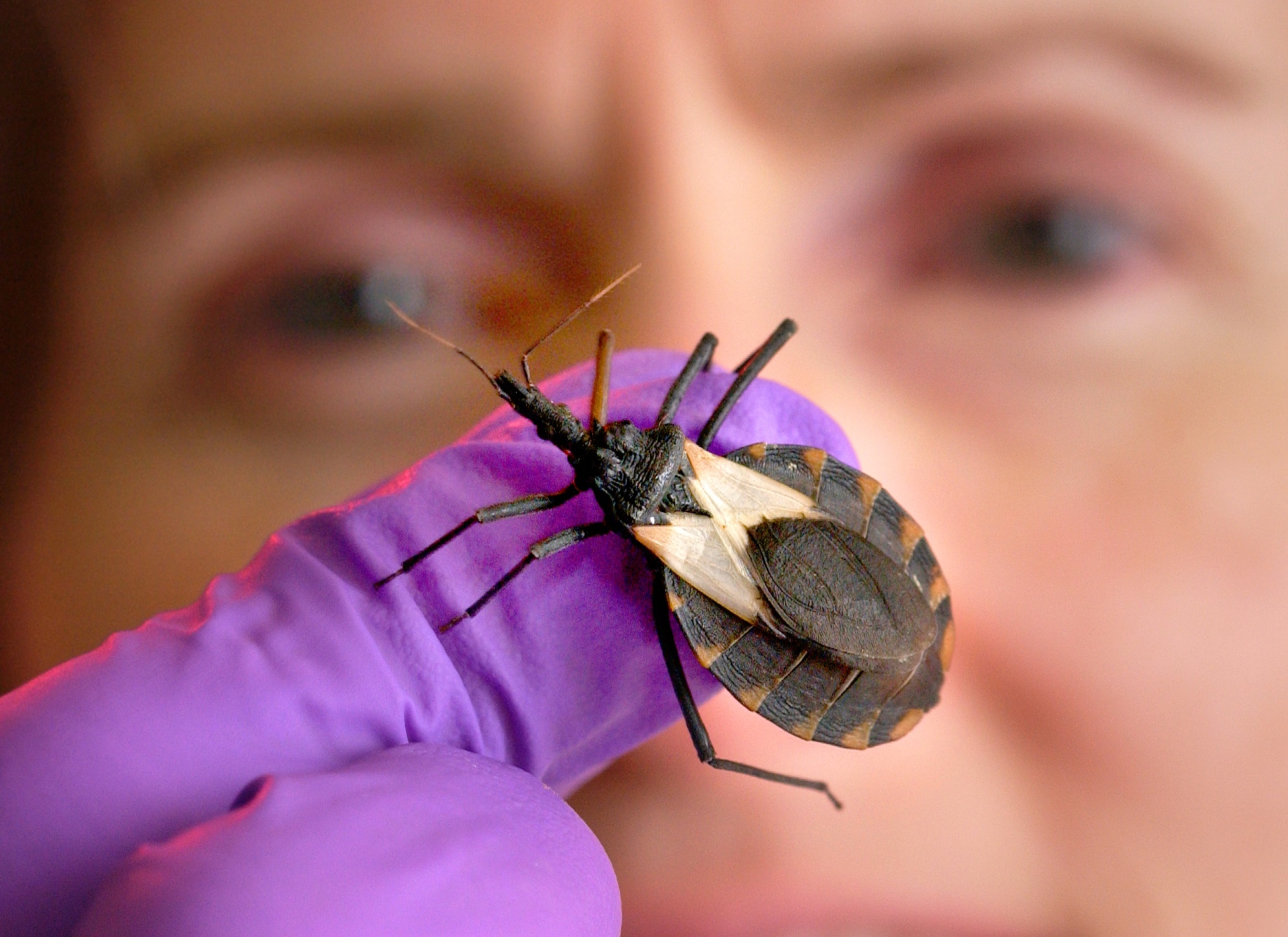 What is Chagas disease? - Vimarsana News