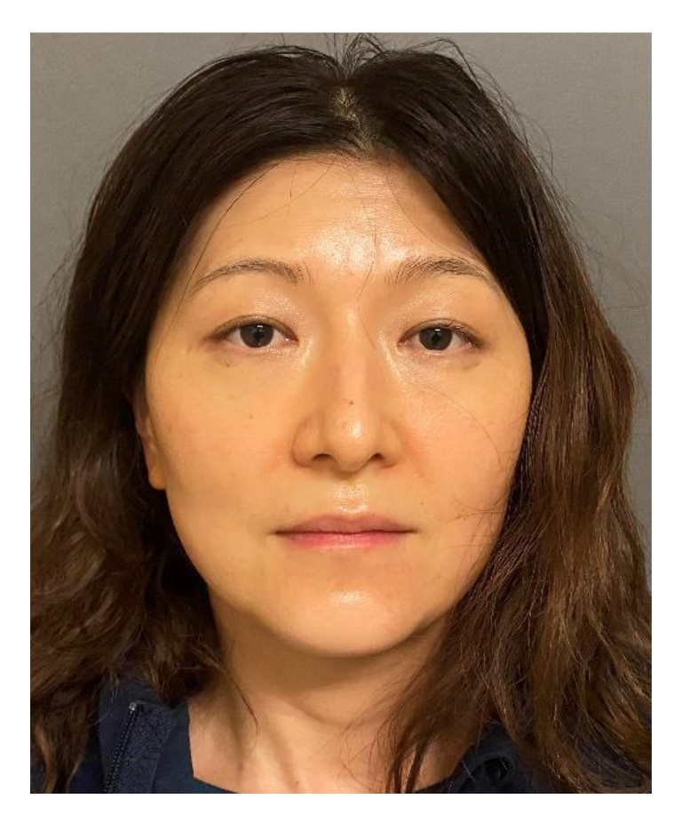Doctor indicted on allegations of poisoning husband's tea with Drano - Vimarsana News